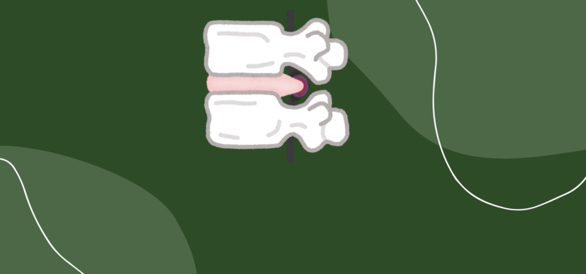 Rwa kulszowa Bydgoszcz – jak wygląda skuteczna rehabilitacja bez operacji?